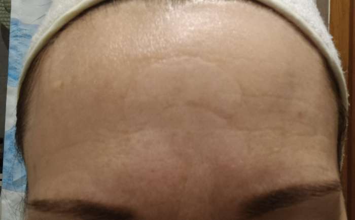 Фотография покупателя товара Тейп для носогубной зоны и висков, набор, 24 штуки - Фото 1