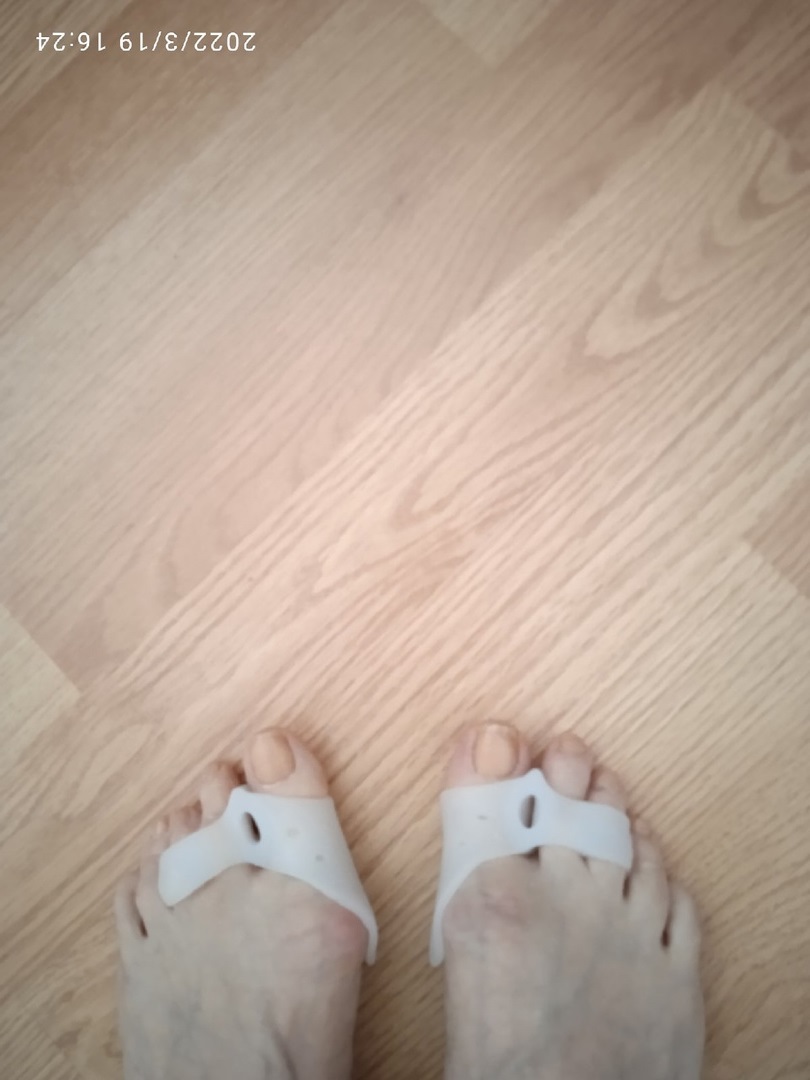 Фотография покупателя товара Корректоры - разделители для пальцев ног, с накладкой на косточку большого пальца, 1 разделитель, силиконовые, 7,5 × 6 см, пара, цвет белый