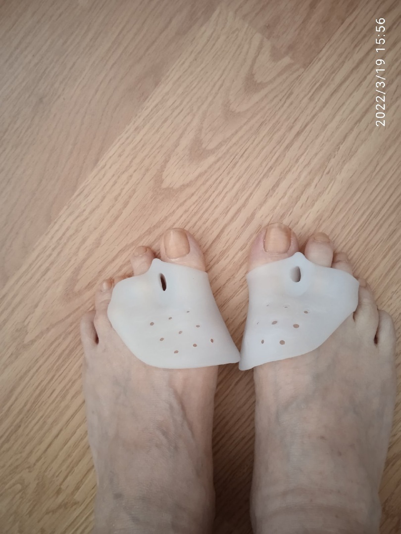 Фотография покупателя товара Корректоры - разделители для пальцев ног, с накладкой на косточку большого пальца, 1 разделитель, силиконовые, 7,5 × 6 см, пара, цвет белый - Фото 1