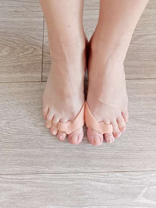 Фотография покупателя товара Корректоры - разделители для пальцев ног, с накладкой на косточку большого пальца, 2 разделителя, силиконовые, 7 × 5 × 2,5 см, пара, цвет бежевый