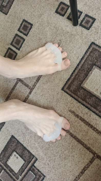 Фотография покупателя товара Корректоры-разделители для пальцев ног, 4 разделителя, силиконовые, 8 × 3 см, пара, цвет белый - Фото 3