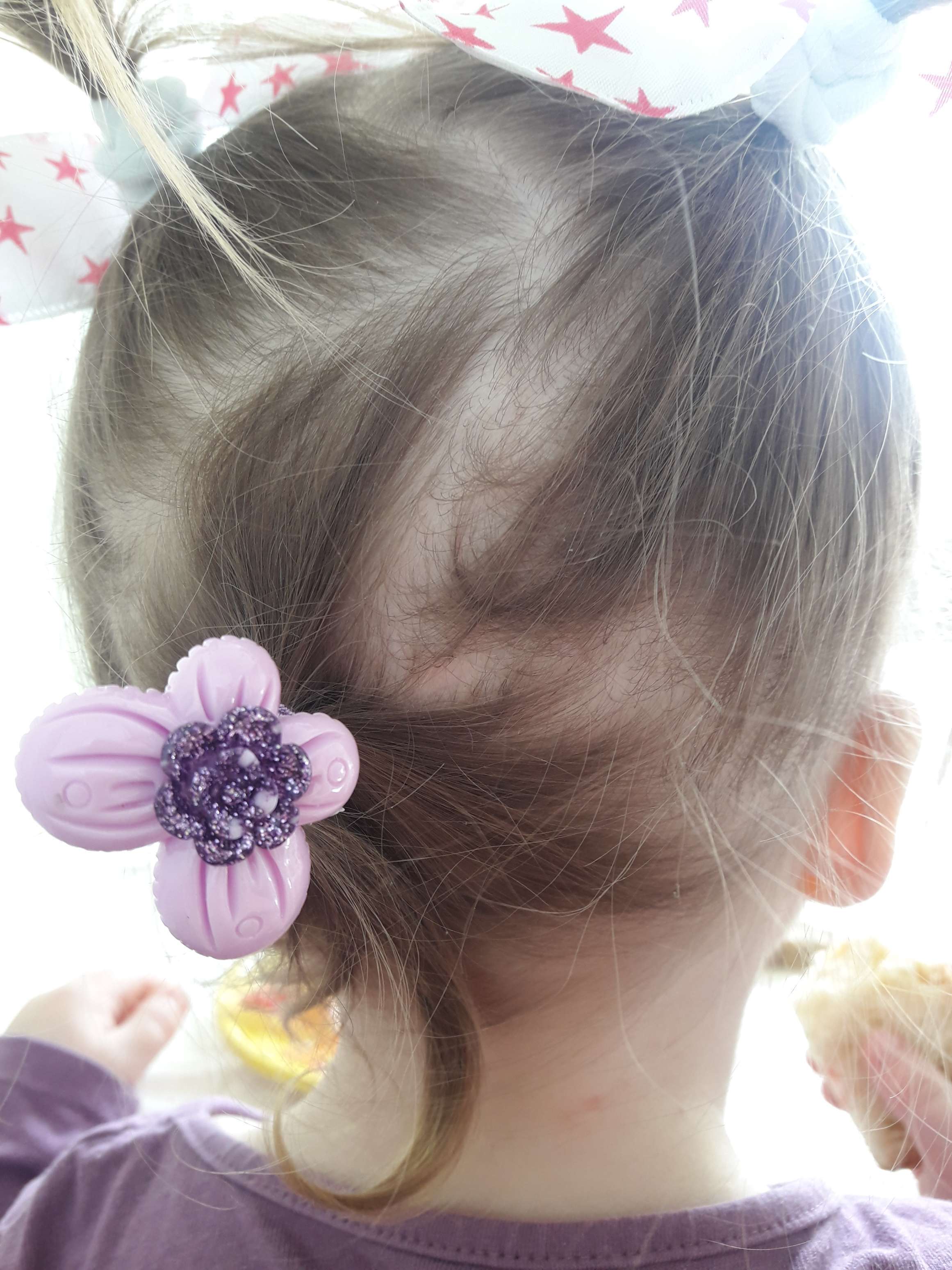 Фотография покупателя товара Резинка для волос "Цветочная" ромашка - Фото 5