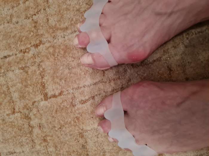 Фотография покупателя товара Корректоры-разделители для пальцев ног, 4 разделителя, силиконовые, 8 × 3 см, пара, цвет белый - Фото 2