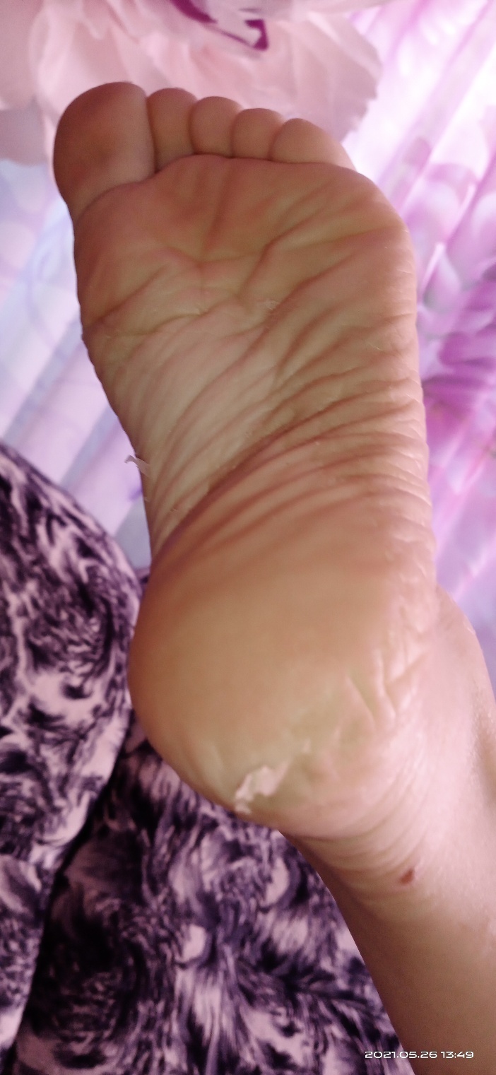 Фотография покупателя товара Отшелушивающие педикюрные носочки El'Skin Peeling Foot, 1 пара - Фото 2