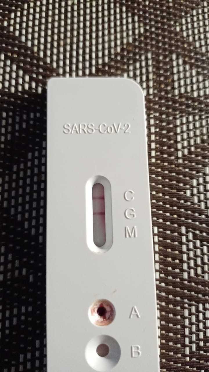 Фотография покупателя товара Экспресс-анализ Leccurate SARS-CoV-2 (COVID-19) для ИВД, индивидуальный набор 1 тест - Фото 1
