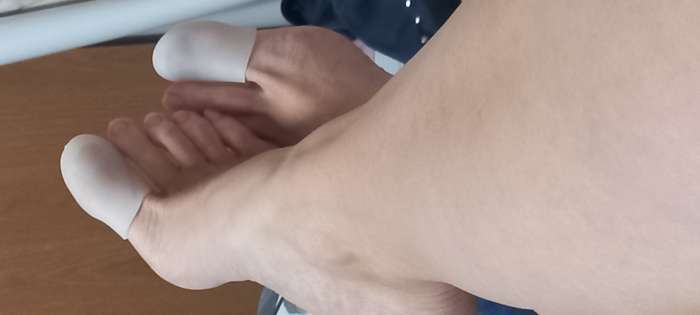 Фотография покупателя товара Напальчники для больших пальцев ног, силиконовые, 5.5×3.5×1 см, пара, белые - Фото 7